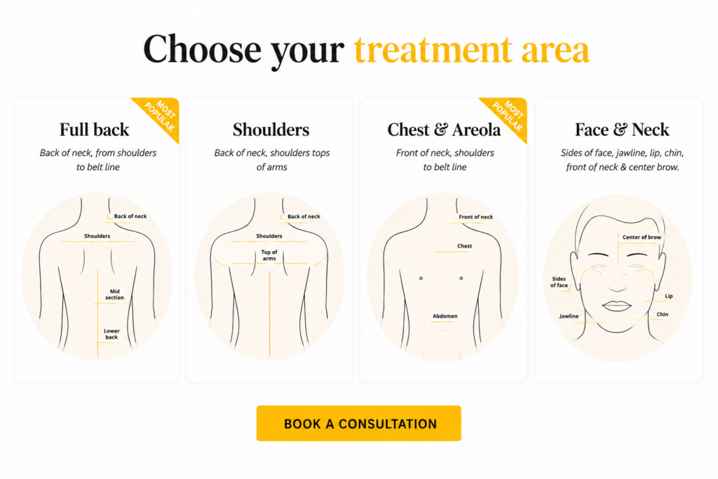 laser hair removal for men